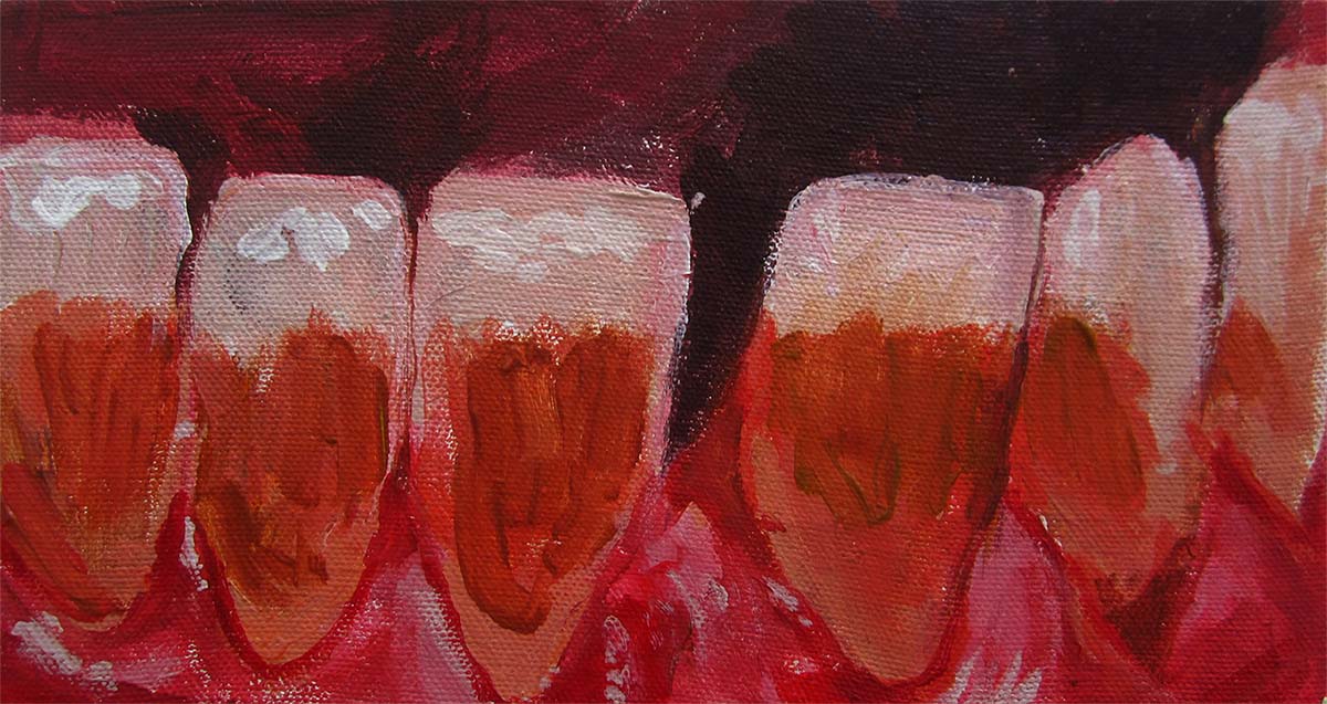 A painting of a close-up section of someone's lower row of teeth, that are stained brown.